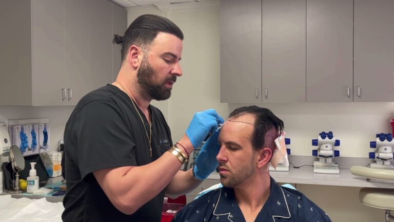 Hair Transplant