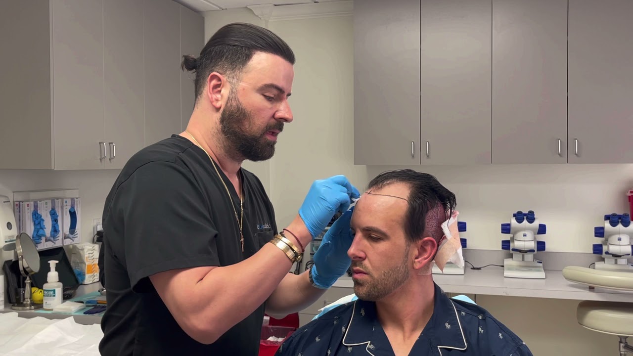 Hair Transplant